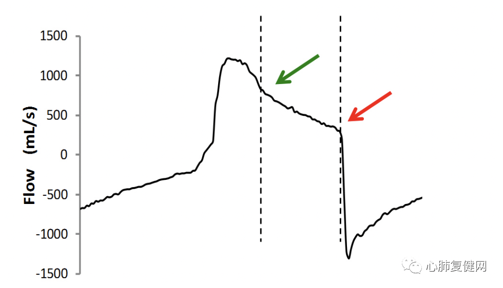 为什么呼吸机人机同步如何提高患者与呼吸机的同步性——第一部分_https://www.jmylbn.com_新闻资讯_第4张