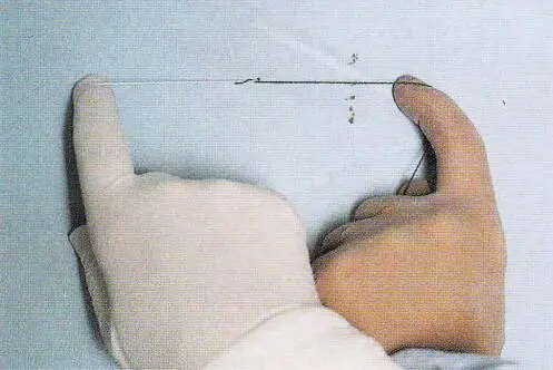 医疗缝线怎么做【临床分享】外科缝合操作，你做对了吗？_https://www.jmylbn.com_新闻资讯_第23张