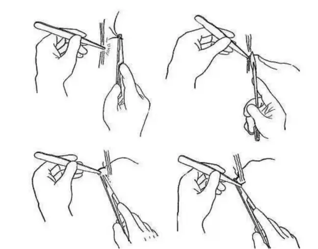 缝伤口怎么打结急诊外科必备技能——清创缝合术_https://www.jmylbn.com_新闻资讯_第5张