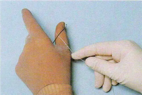 医疗缝线怎么做【临床分享】外科缝合操作，你做对了吗？_https://www.jmylbn.com_新闻资讯_第29张