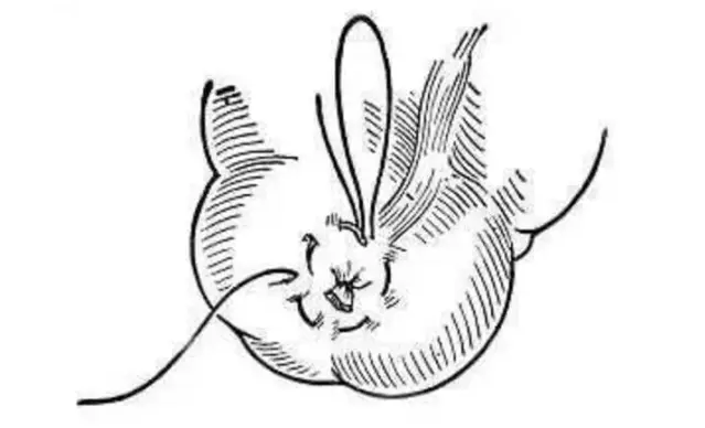 医疗缝线怎么做【临床分享】外科缝合操作，你做对了吗？_https://www.jmylbn.com_新闻资讯_第12张