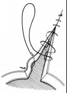 医疗缝线怎么做【临床分享】外科缝合操作，你做对了吗？_https://www.jmylbn.com_新闻资讯_第11张