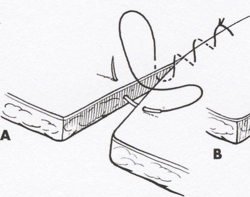 医疗缝线怎么做【临床分享】外科缝合操作，你做对了吗？_https://www.jmylbn.com_新闻资讯_第4张
