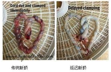 为什么剪脐带要先夹住脐带这么剪，宝宝受益一辈子！_https://www.jmylbn.com_新闻资讯_第11张