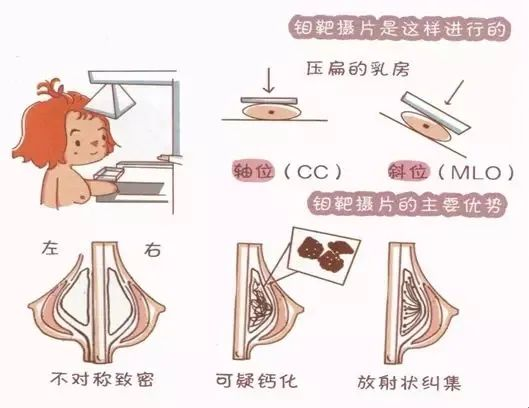 乳腺触诊成像怎么检查妇幼科普 ｜ 乳腺检查，我该怎么选？_https://www.jmylbn.com_新闻资讯_第6张