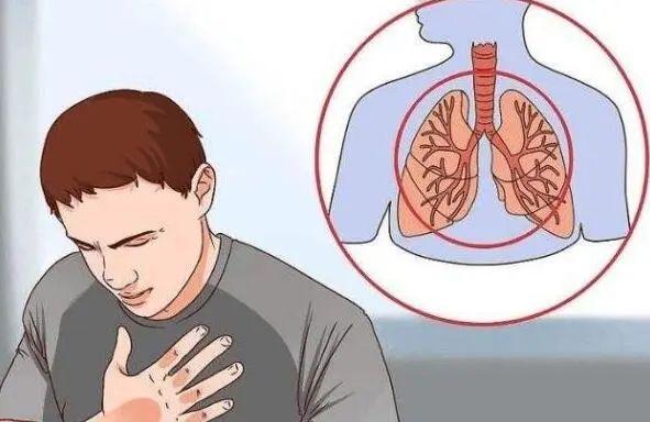 排痰背心怎么用这件“背心”与众不同，穿上可以轻松排痰！_https://www.jmylbn.com_新闻资讯_第13张