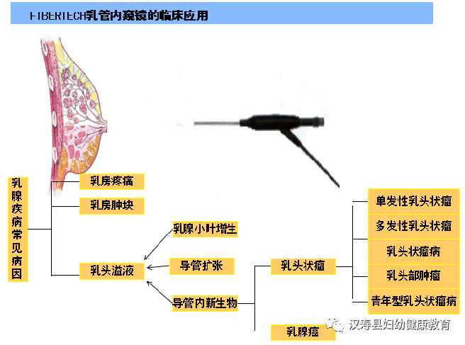 乳腺触诊成像怎么检查妇幼科普 ｜ 乳腺检查，我该怎么选？_https://www.jmylbn.com_新闻资讯_第13张