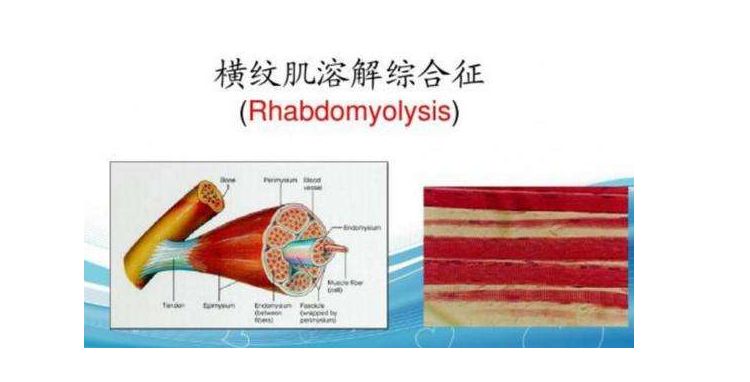 運動不僅燃燒卡路里 過量還會「溶解」細胞危及生命？ 健康 第3張