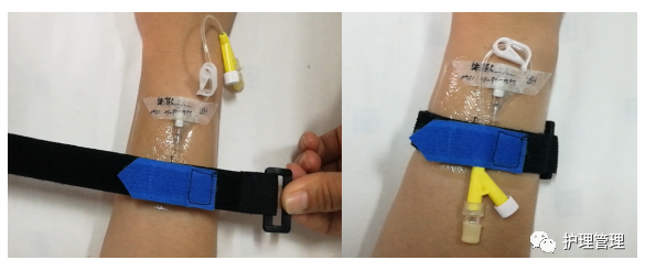 普通留置针怎么固定这个护理创新太小巧，护士用过都说好！_https://www.jmylbn.com_新闻资讯_第5张