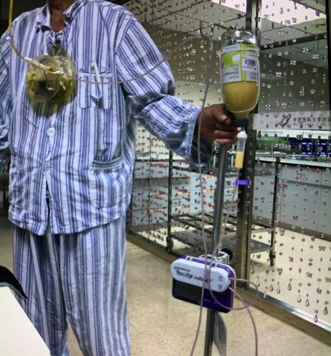 一次性胃管干什么用的护士把鼻饲真是“玩明白了”！这几个护理小发明真的很好用_https://www.jmylbn.com_新闻资讯_第11张