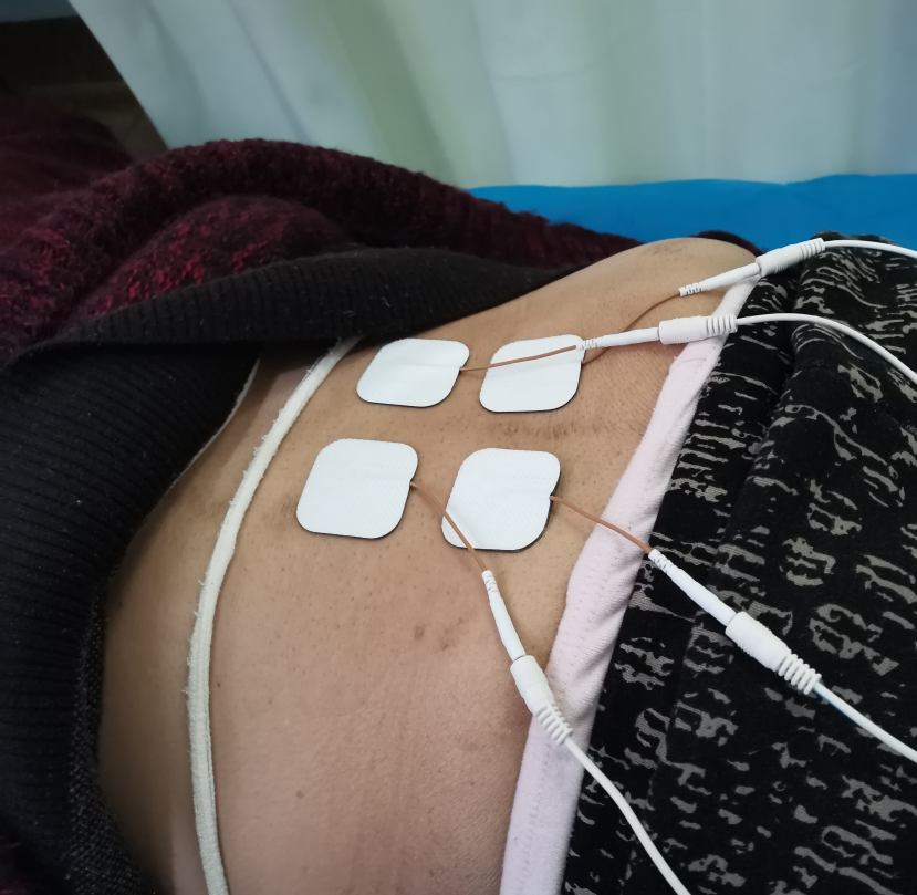 中频为什么能镇痛【乐“医”为您】康复治疗物理因子篇——中频电治疗_https://www.jmylbn.com_新闻资讯_第6张