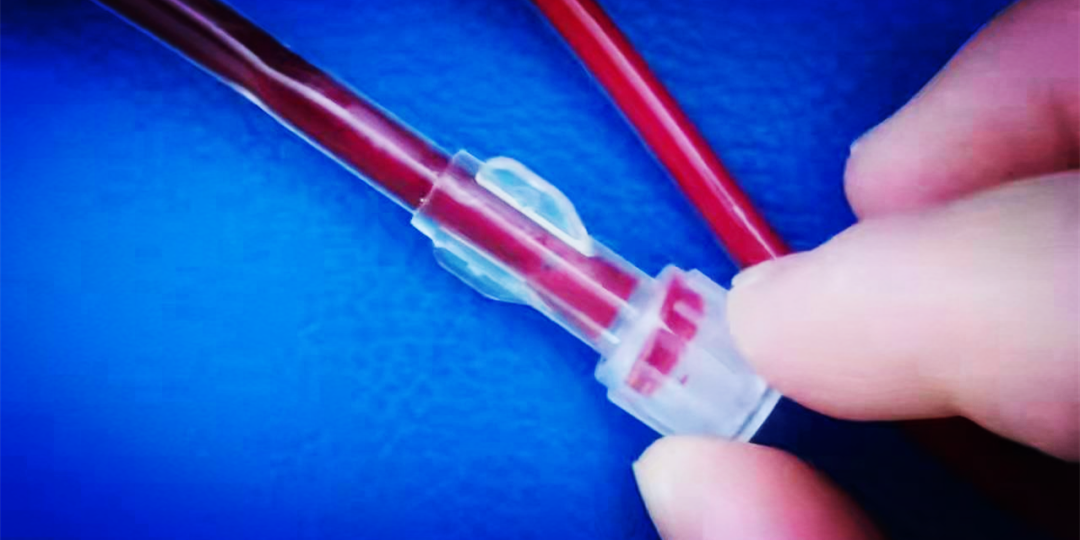 三氧疗法怎么代理医美+血液净化=高端骗局！“三氧疗法”“血液净化”啥区别？_https://www.jmylbn.com_新闻资讯_第2张