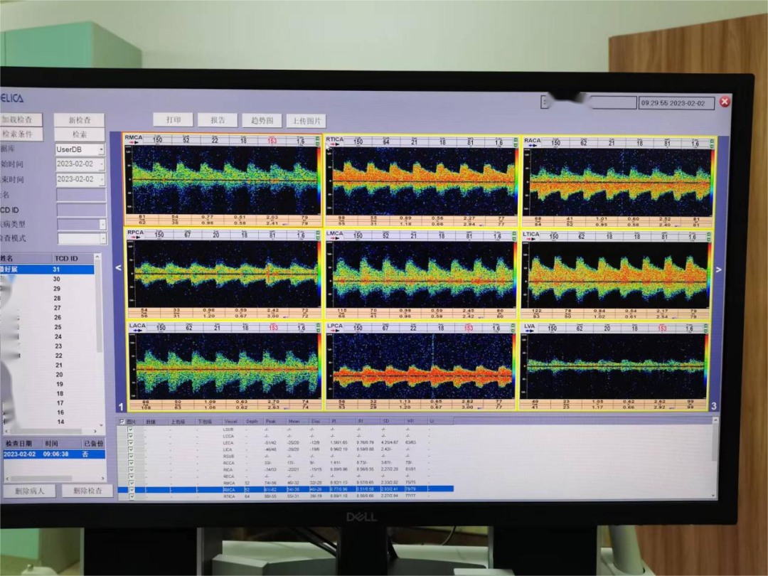 tcd2000怎么样天等县人民医院引进新设备：超声经颅多普勒血流分析仪_https://www.jmylbn.com_新闻资讯_第2张