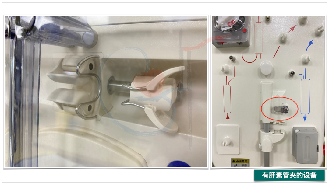 为什么要用泵上注射器小隐患大事故，透析时肝素泵管接口漏血，如何预防？_https://www.jmylbn.com_新闻资讯_第6张