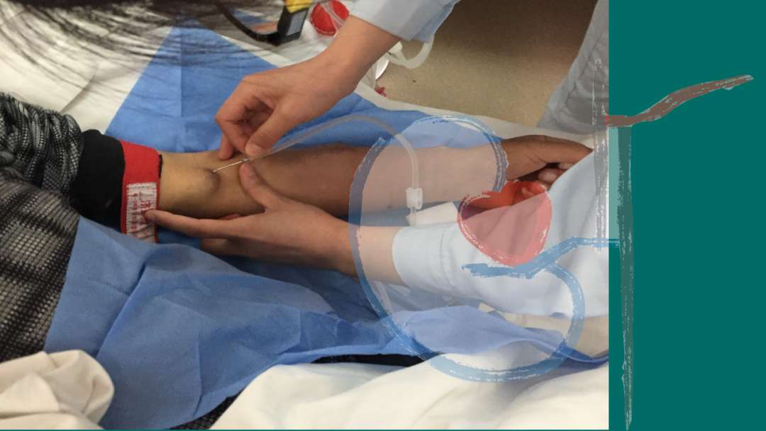 为什么一次性压脉带透析问答｜用内瘘压脉带替代止血带，可不可以呢？_https://www.jmylbn.com_新闻资讯_第5张