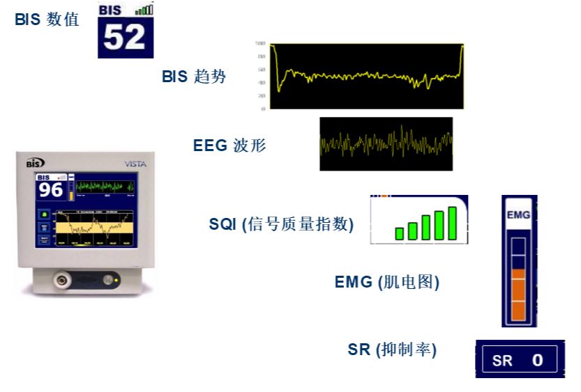 bis电极怎么接脑电图BIS监护仪及COVIDIEN（柯惠）脑电传感器介绍_https://www.jmylbn.com_新闻资讯_第4张