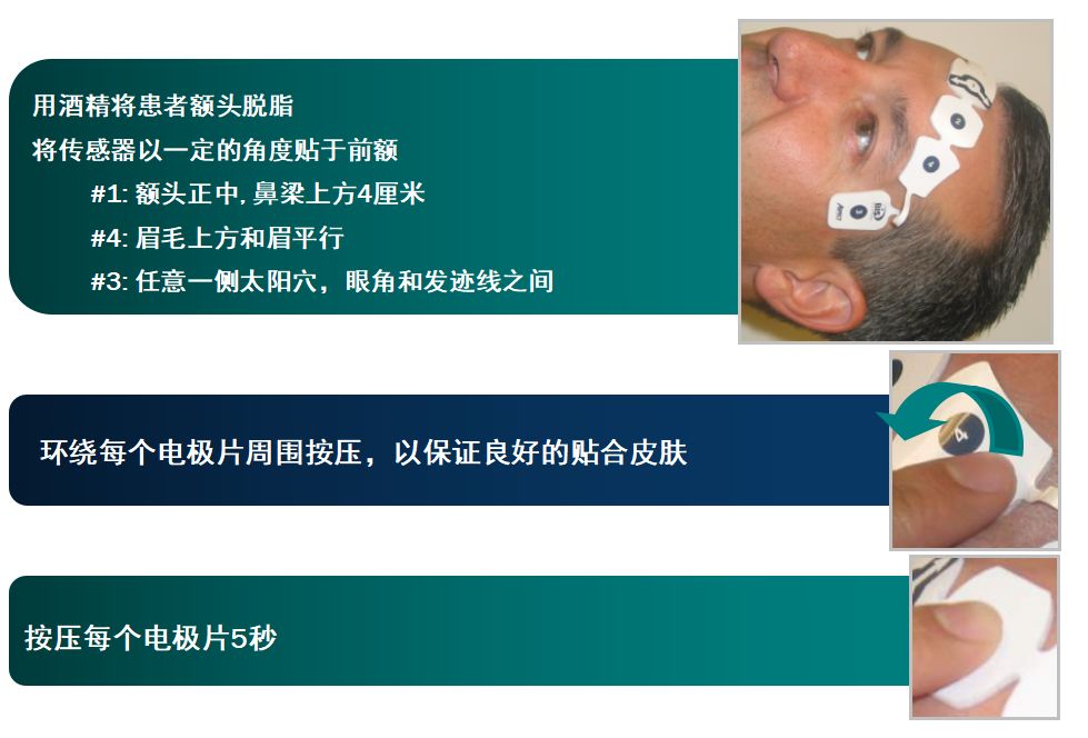 bis电极怎么接脑电图BIS监护仪及COVIDIEN（柯惠）脑电传感器介绍_https://www.jmylbn.com_新闻资讯_第7张
