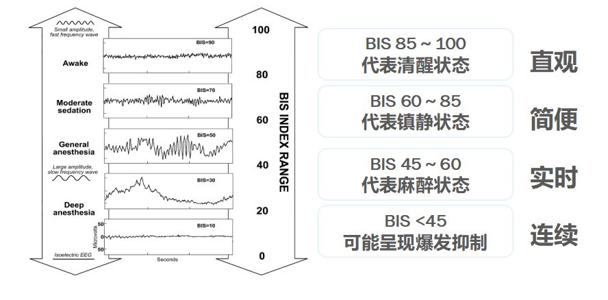bis电极怎么接脑电图BIS监护仪及COVIDIEN（柯惠）脑电传感器介绍_https://www.jmylbn.com_新闻资讯_第2张