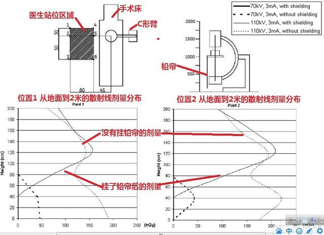 拍片机怎么用C臂机拍片时，该怎么做才能避免“误伤”？_https://www.jmylbn.com_新闻资讯_第7张