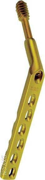 生物钉是什么材料骨折常用内固定材料&选择原则，超详细！_https://www.jmylbn.com_新闻资讯_第65张