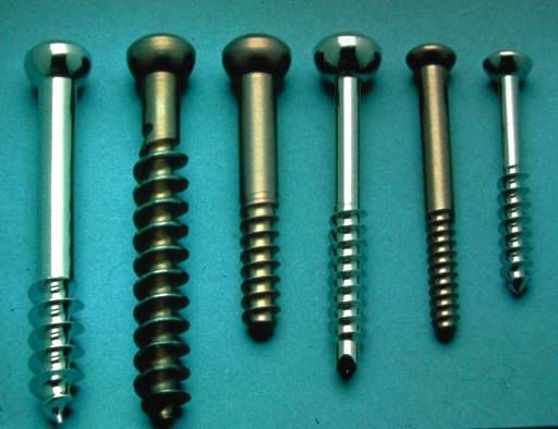 生物钉是什么材料骨折常用内固定材料&选择原则，超详细！_https://www.jmylbn.com_新闻资讯_第53张