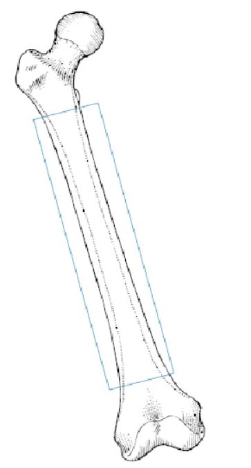生物钉是什么材料骨折常用内固定材料&选择原则，超详细！_https://www.jmylbn.com_新闻资讯_第58张