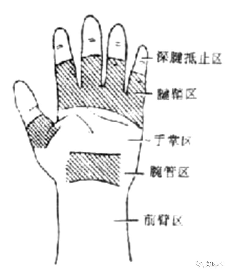 什么是无创缝合肌腱缝合术原则及方法汇总，分享给你~_https://www.jmylbn.com_新闻资讯_第7张