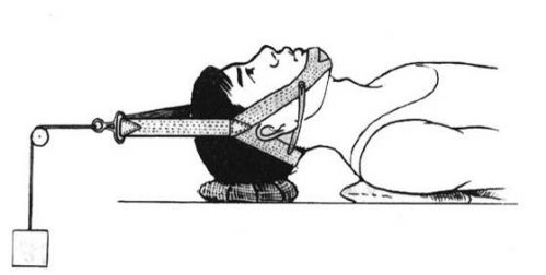 脊柱骨折的分型、诊断与治疗