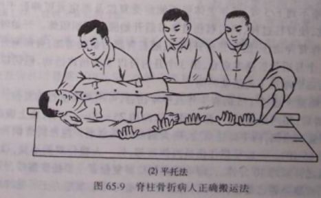 脊柱骨折的分型、诊断与治疗