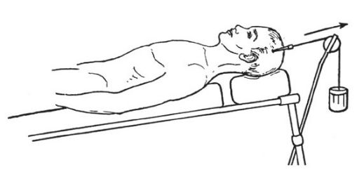 脊柱骨折的分型、诊断与治疗