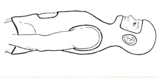 脊柱骨折的分型、诊断与治疗