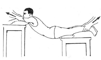 脊柱骨折的分型、诊断与治疗