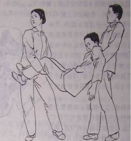 脊柱骨折的分型、诊断与治疗