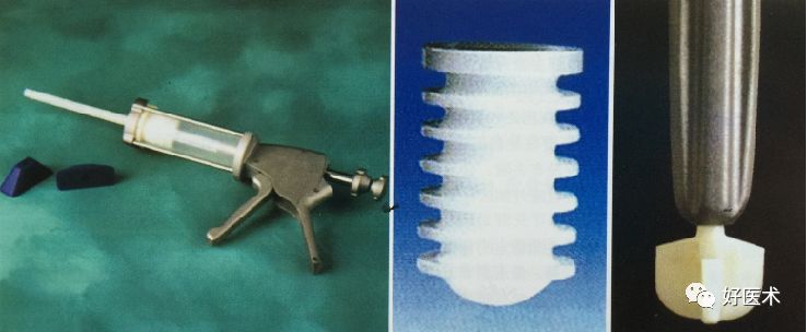 如何做好人工髋关节置换术？这篇全是干货！