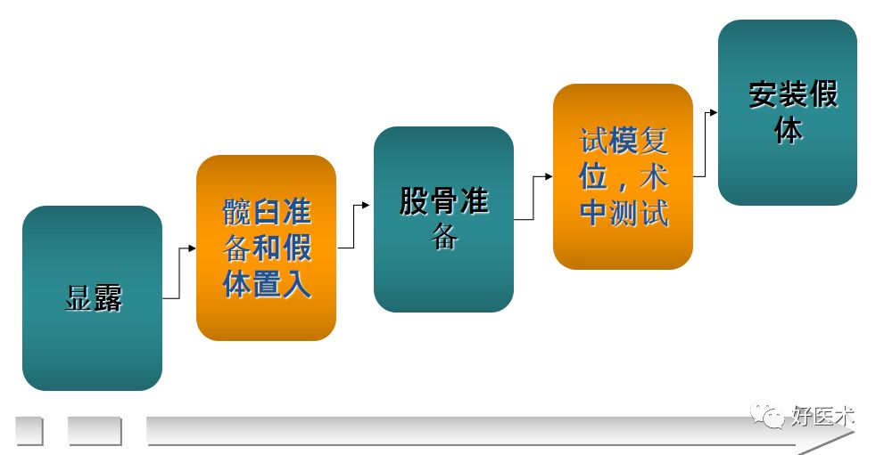 如何做好人工髋关节置换术？这篇全是干货！