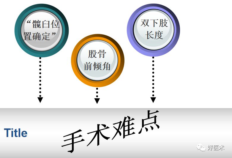 如何做好人工髋关节置换术？这篇全是干货！