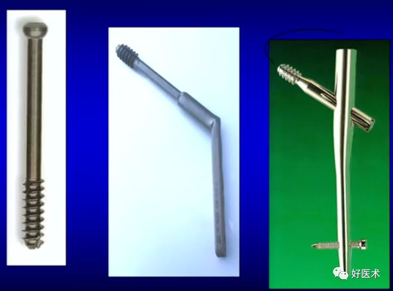 手把手教程：打牢转子间髓内钉，技巧在这！