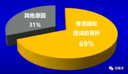 手把手教程：打牢转子间髓内钉，技巧在这！