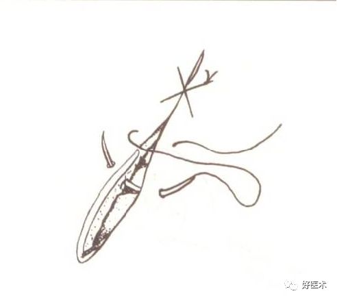 缝线怎么打结外科手术操作 ｜ 打开手术通路之缝合打结_https://www.jmylbn.com_新闻资讯_第4张