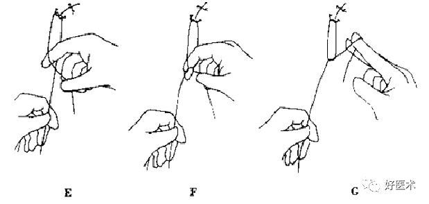 缝线怎么打结外科手术操作 ｜ 打开手术通路之缝合打结_https://www.jmylbn.com_新闻资讯_第20张