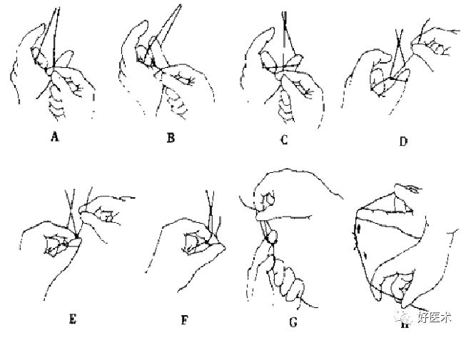缝线怎么打结外科手术操作 ｜ 打开手术通路之缝合打结_https://www.jmylbn.com_新闻资讯_第22张