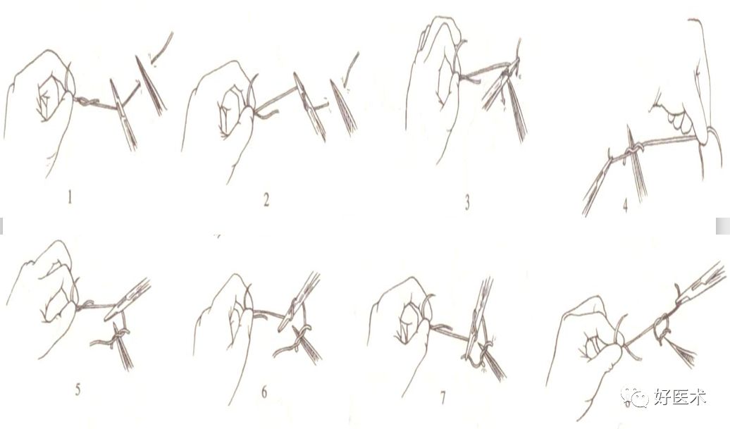 缝线怎么打结外科手术操作 ｜ 打开手术通路之缝合打结_https://www.jmylbn.com_新闻资讯_第17张