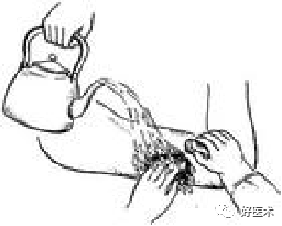 分离结扎钳怎么用【学生频道】外科手术基本功速成法，书上学不到的秘诀！（聂邯洛医师推荐）_https://www.jmylbn.com_新闻资讯_第63张