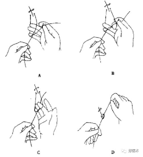 缝线怎么打结外科手术操作 ｜ 打开手术通路之缝合打结_https://www.jmylbn.com_新闻资讯_第19张