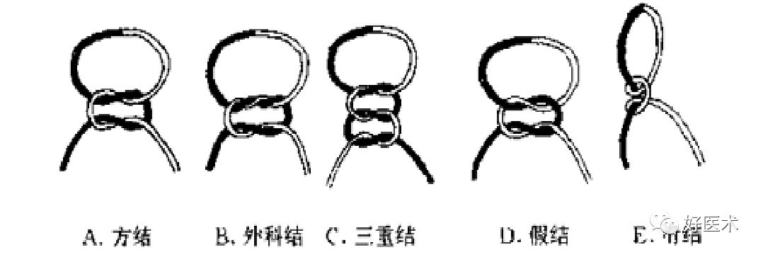 缝线怎么打结外科手术操作 ｜ 打开手术通路之缝合打结_https://www.jmylbn.com_新闻资讯_第25张