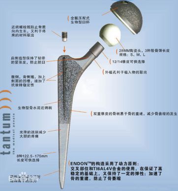 生物钉是什么材料骨折常用内固定材料&选择原则，超详细！_https://www.jmylbn.com_新闻资讯_第81张