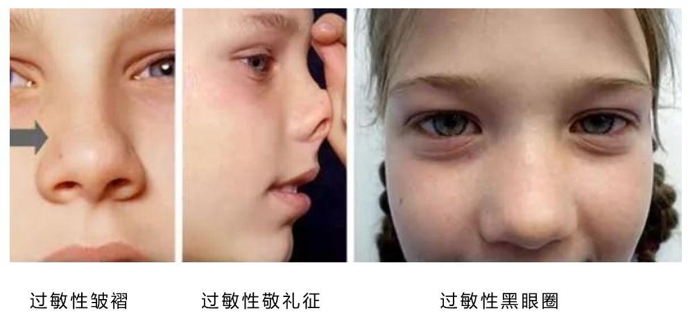 鼻炎还没调理好，鼻窦炎又来了，一个“感冒”竟惹来这么多病？