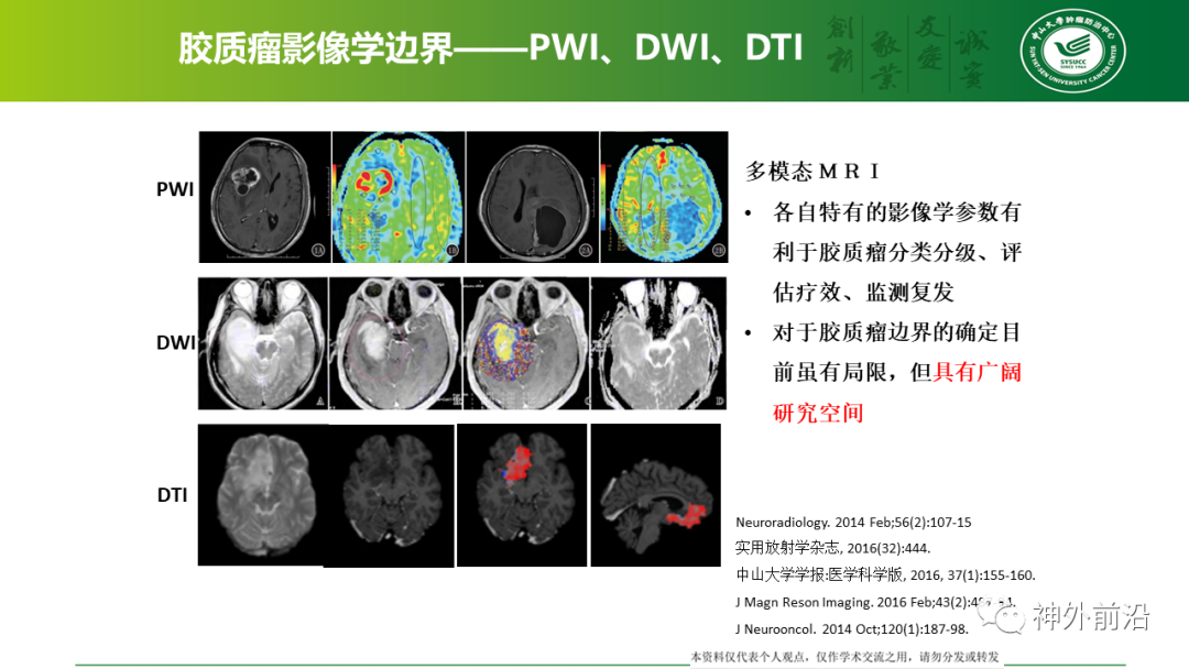 中山肿瘤牟永告:胶质瘤边界 之我见