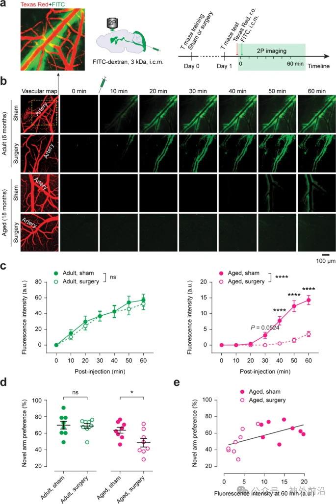 怎么清除麻醉学术动态 ｜ 麻醉和手术对脑类淋巴系统清除代谢废物及认知功能的影响  一项动物实验结果_https://www.jmylbn.com_新闻资讯_第2张