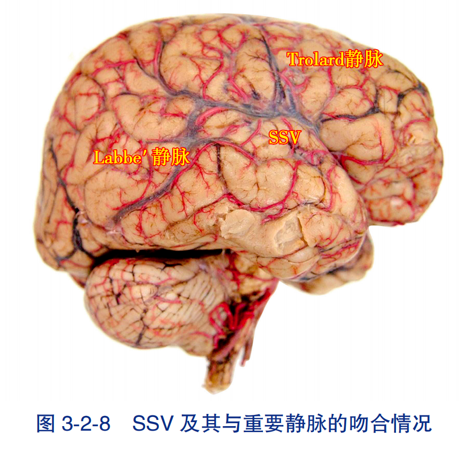 (2)靜脈:側裂淺靜脈(superficial sylvian vein,ssv),起自大腦外側裂